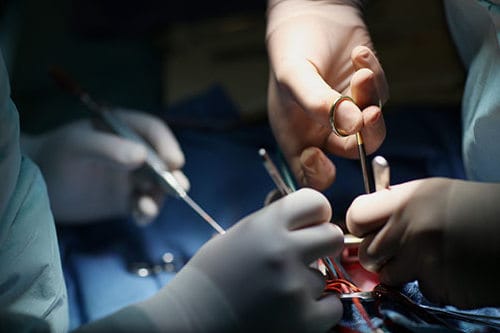 MESA – vi phẫu lấy tinh trùng ở mào tinh phau-thuat-lay-tinh-trung-trong-dieu-tri-vo-sinh-nam-3