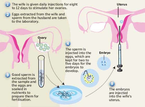 Kỹ thuật IVF hỗ trợ việc tìm người mang thai hộ ky-thuat-IVF-ho-tro-viec-tim-nguoi-mang-thai-ho