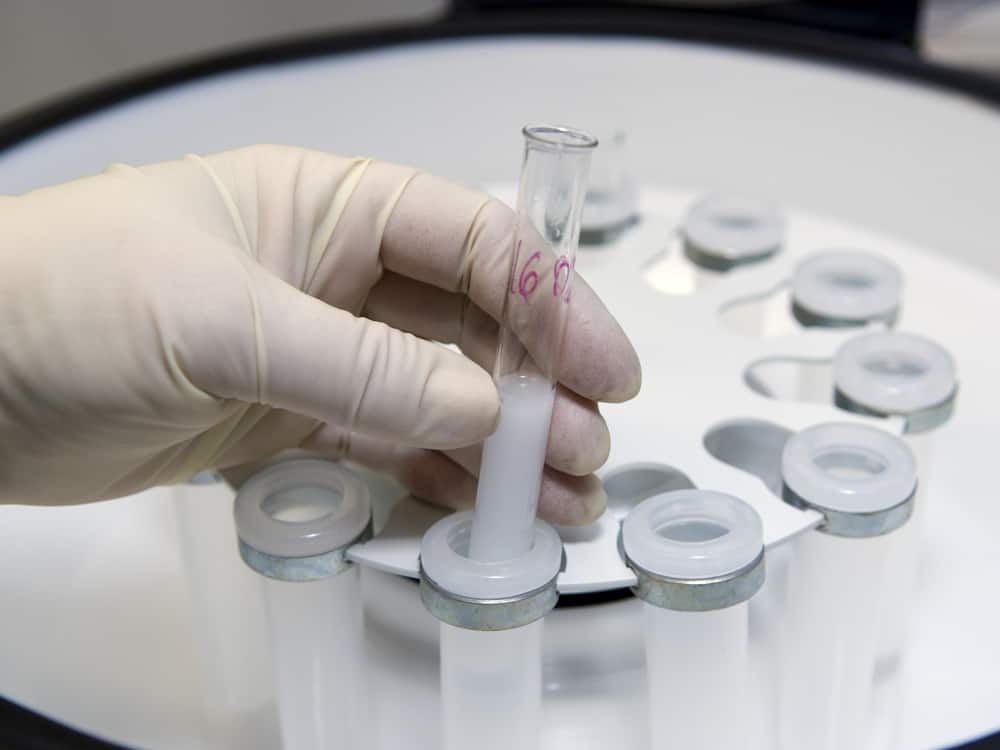 vô sinh không rõ nguyên nhân 1 Điều trị vô sinh không rõ nguyên nhân, vô sinh không rõ nguyên nhân