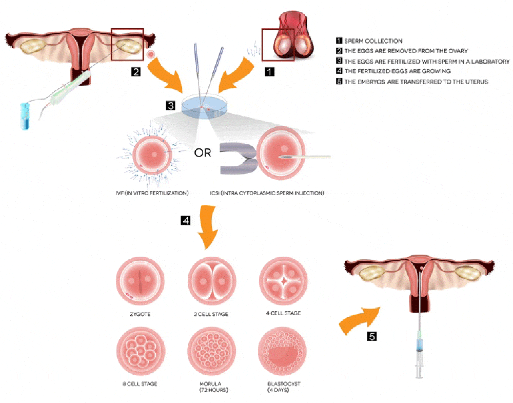 Quy trình hiến tặng trứng 1