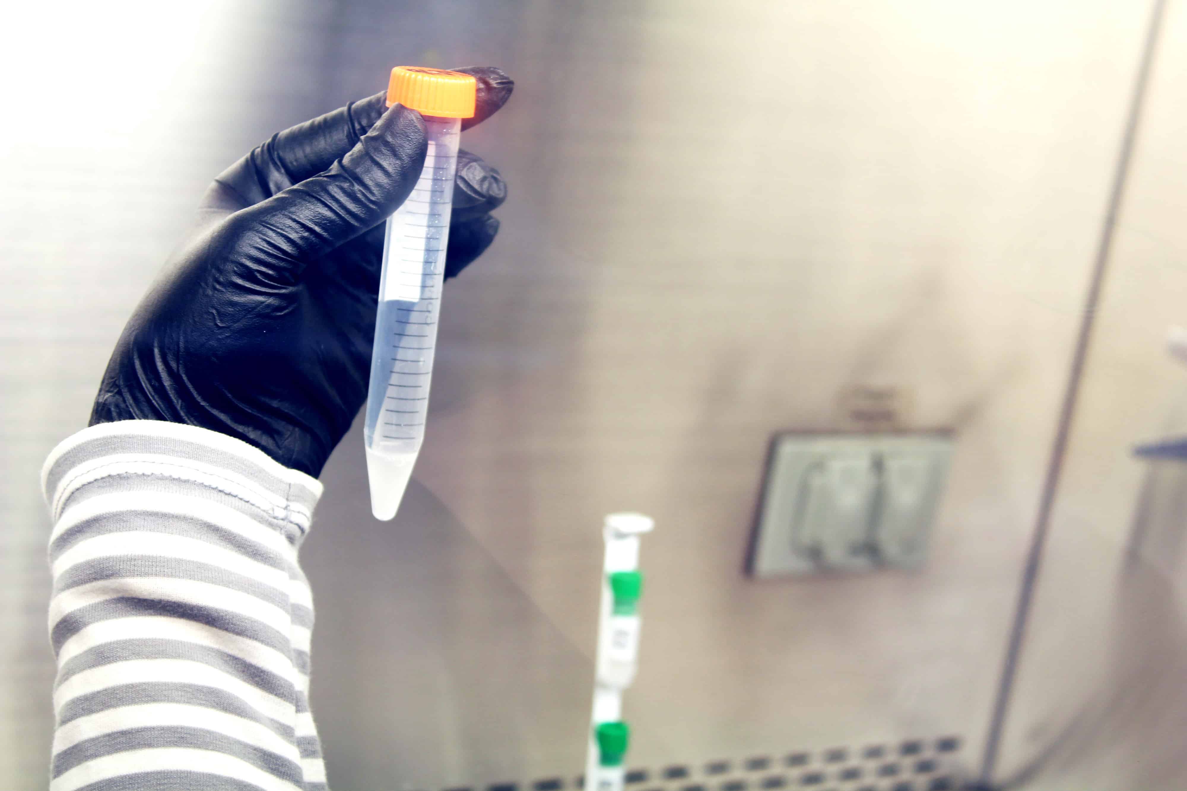 Tìm ra phương pháp chữa bệnh vô sinh bằng tinh trùng nhân tạo 8 Tìm ra phương pháp chữa bệnh vô sinh bằng tinh trùng nhân tạo 7