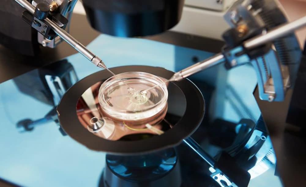 Phát hiện mới làm tăng tỷ lệ thành công trong điều trị vô sinh cho phụ nữ lớn tuổi 7 Phát hiện mới làm tăng tỷ lệ thành công trong điều trị vô sinh cho phụ nữ lớn tuổi 6