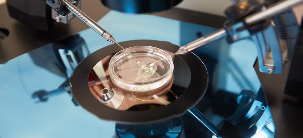 điều trị vô sinh hiếm muộn 3