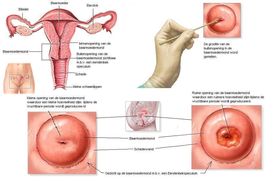 Điều trị vô sinh bằng IUI 4