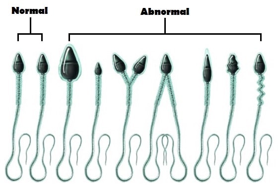 nam giới cần biết về tinh trùng