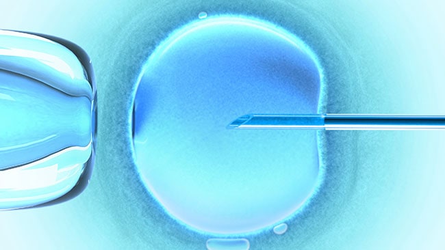 Ưu điểm của phương pháp IVF “3 gene” uu-diem-cua-phuong-phap-3-gene-1