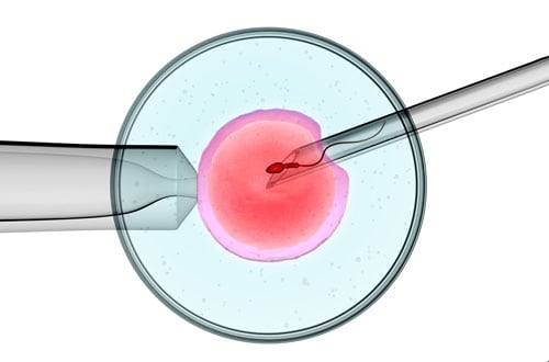dieu-tri-vo-sinh-nam-o-dau-ha-noi-3