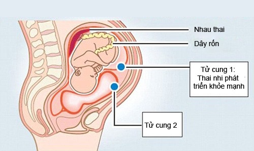 Có phụ nữ có tới 2 tử cung giai-ma-7-dieu-thu-vi-ve-kha-nang-sinh-san-cua-phu-nu-4.