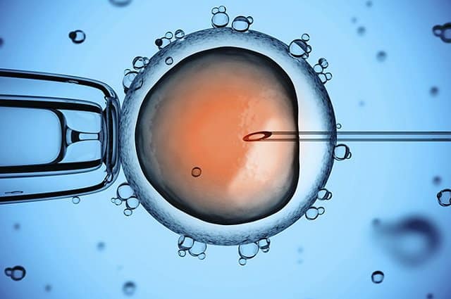 Điều trị thiểu năng tinh trùng nguyen-nhan-va-phuong-phap-dieu-tri-thieu-nang-tinh-trung-4