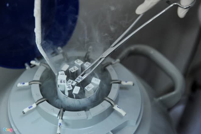 Khi nào nên lưu trữ tinh trùng? tim-hieu-ve-luu-tru-tinh-trung-3