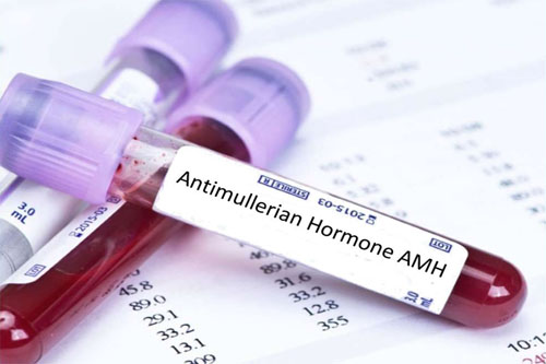 Xét nghiệm AMH là gì? AMH thấp ảnh hưởng tới khả năng sinh sản của phụ nữ