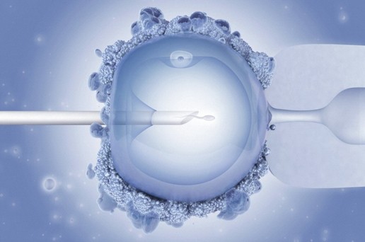 ICSI - Tối ưu hiệu quả cho quá trình thụ tinh trong ống nghiệm (IVF) ICSI - Tối ưu hiệu quả cho quá trình thụ tinh trong ống nghiệm (IVF)