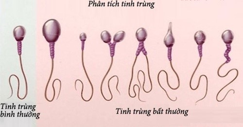 dieu-tri-vo-sinh-nguyen-phat-2