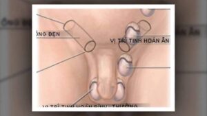 nhung-yeu-to-gay-vo-sinh-bam-sinh-o-nam-gioi-1