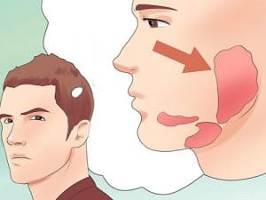 viem-tinh-hoan-sau-quai-bi-1