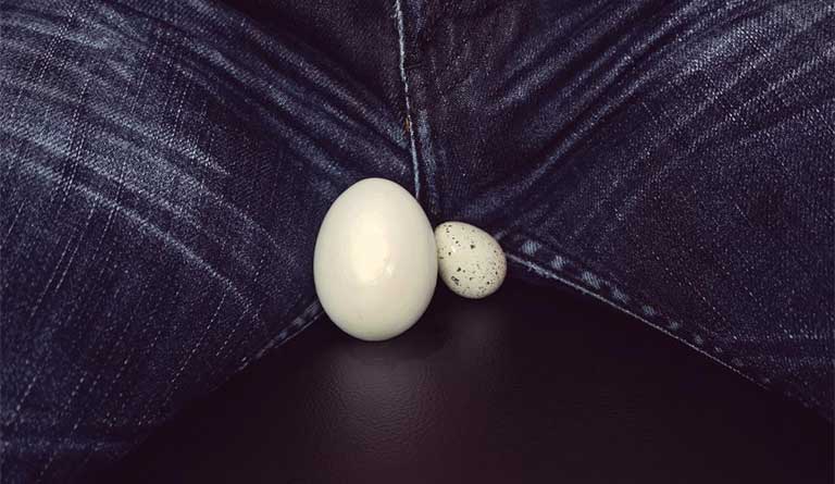 Tinh hoàn không đều