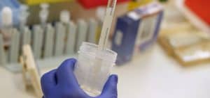 Tìm hiểu thủ thuật lấy tinh trùng ở nam giới - Trung tâm IVF Hồng Ngọc