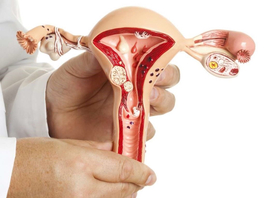 Suy buồng trứng sớm phải làm thế nào? - Trung tâm IVF Hồng Ngọc