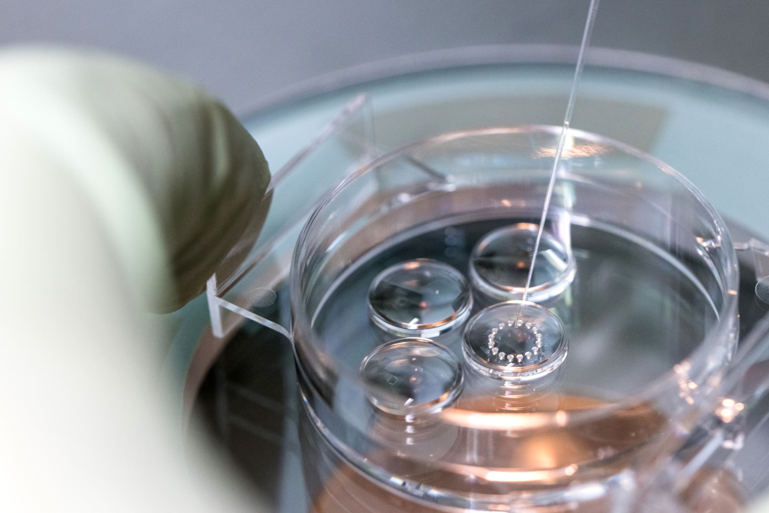 Quy trình IVF tại Trung tâm IVF Hồng Ngọc