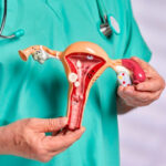 Cắt buồng trứng có kinh nguyệt bình thường hay không?