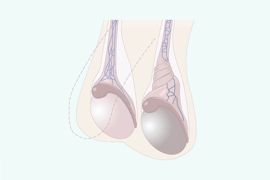 Tinh hoàn bình thường của nam giới trưởng thành